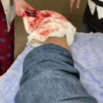 Rafael Vitti Instagram - (CONTEÚDO SENSÍVEL : SANGUE CENOGRÁFICO ) Bastidores de qualidade duvidosa da sequência do tiro no pé. #TerraEPaixão #Bastidores Estúdios Globo