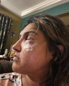 Vanitha Vijayakumar Instagram - Posting my brutal attack with a lot of bravery. #biggbosstamil is just a game show and this is not right . Violence is not right
