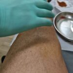 Zlatan Ibrahimović Instagram – Emptied the knee once a week for six months