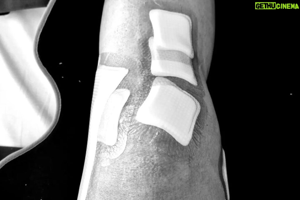 Zlatan Ibrahimović Instagram - For the past six months I played without an ACL in my left knee. Swollen knee for six months. I was only able to train with the team 10 times in the last six months. Took more than 20 injections in six months. Emptied the knee once a week for six months. Painkillers every day for six months. Barely slept for six months because of the pain. Never suffered so much on and off the pitch. I made something impossible to something possible. In my mind I had only one objective, to make my teammates and coach champions of Italy because I made them a promise. Today I have a new ACL and another trophy