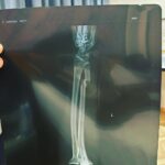 Alex Caceres Instagram - First I would like to thank my wife and teammates @zen_ronin_ and @themmalab, my managers @firstroundmgmt, as well as the @ufc for the opportunity. Tonight wasn’t my night, i broke my forearm blocking a head kick in the first round and tried my best to win even through the pain. Hats off to @knockoutcancer for a grate fight