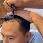 Andre Soukhamthath Instagram - I recently got my hair restoration and it was an AMAZING experience. The process went by fast and I was as comfortable as ever. Hip, trendy, stylish, and cool? Yup, that was the @bsgdispatch experience!!!! #hairrestoration #hairreplacement