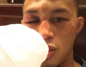 Andre Soukhamthath Instagram - The month of May is Asian American & Pacific Islander Month. I just want to encourage the next Asian-American generation to always follow your heart and always follow your dreams. The road is NOT easy. In-fact it could be very ugly, painful, and discouraging. 
But if you have a dream worth fighting for, you need to push through it and work at it everyday! 
Cause there’s beauty in the struggle 🙏🏽💪🏽👊🏽🇱🇦🇺🇸
#aapiheritagemonth #Laos #UFC