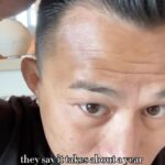 Andre Soukhamthath Instagram - A six month update from @andresoukmma - although Andre is only about halfway to his final result, notice the subtle shift in his hairline. Natural and soft. Too often we receive requests for straight across, thick and unnatural hairlines. And just as often we are correcting these type of hairlines. Stick to what looks natural and you’ll always be happy. . Thanks for the update, Andre. We are proud to partner with you!