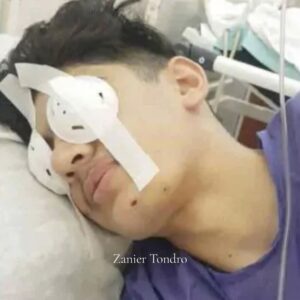 Angelina Jolie Instagram - Thinking of the young Iranians who have suffered eye injuries protesting the killing of Mahsa Amini, like @elahetavokolian14 and Zanier Tondro. Many survivors have lost sight in one or both eyes. It’s a reminder of the price young Iranians are paying in their struggle for rights and freedoms. 

#womanlifefreedom #Iran #mahsaamini #elahetavokolian #zaniertondro