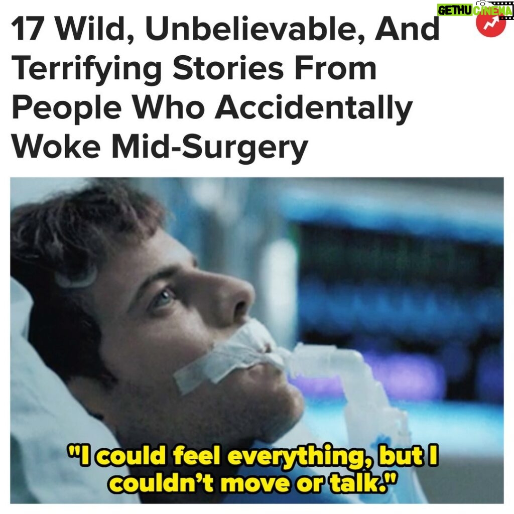 Buzzfeed Instagram - "I remember waking up during my wisdom teeth surgery. I woke up to a buzzing vibration. That was when I knew exactly what they were doing — they were sawing my teeth into pieces." More at the link in bio 😳