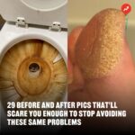 Buzzfeed Instagram – Take another look if you dare — the pics are pretty terrifying. 🫣 If you wanna see the “after” results, head to the link in our bio 🔗