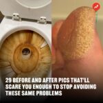 Buzzfeed Instagram - Take another look if you dare — the pics are pretty terrifying. 🫣 If you wanna see the "after" results, head to the link in our bio 🔗