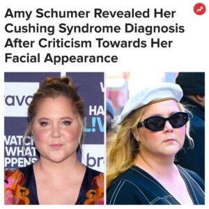 Buzzfeed Instagram - "Aside from fears about my health, I also had to be on camera having the internet chime in." More at the link in our bio 👆