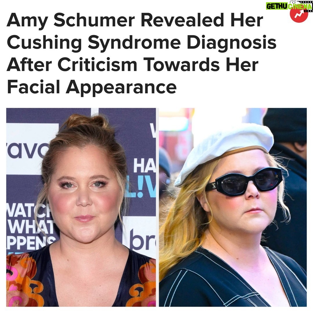 Buzzfeed - 5.5K Likes - "Aside from fears about my health, I also had to be on camera having the internet chime in." More at the link in our bio 👆