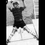 Cameron Mathison Instagram - In honor or Rare Disease Day I’m posting about the rare degenerative bone disease I had as child: Legg Calve Perthes Disease. I was diagnosed at two years old and wore this leg brace night and day for 4 years to allow my femur bones to harden and support my body. The treatment has come a long way since then, but still so much to learn about this rare disease. @leggcalveperthes and @pertheskids are two great organizations to support and to learn more🙏🏼 #rarediseaseday #rarediseaseawareness #leggcalveperthes