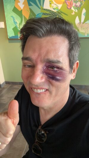 Celso Portiolli Instagram - Deu errado 😞
