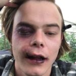 Charlie Heaton Instagram – He hit me and it felt like a kiss #asyouare