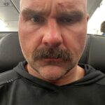 David Michael Harwood Instagram - Split open forehead. Swollen eye. Fresh blood. I wonder what these business folk think in first class. All for the love of the Game.