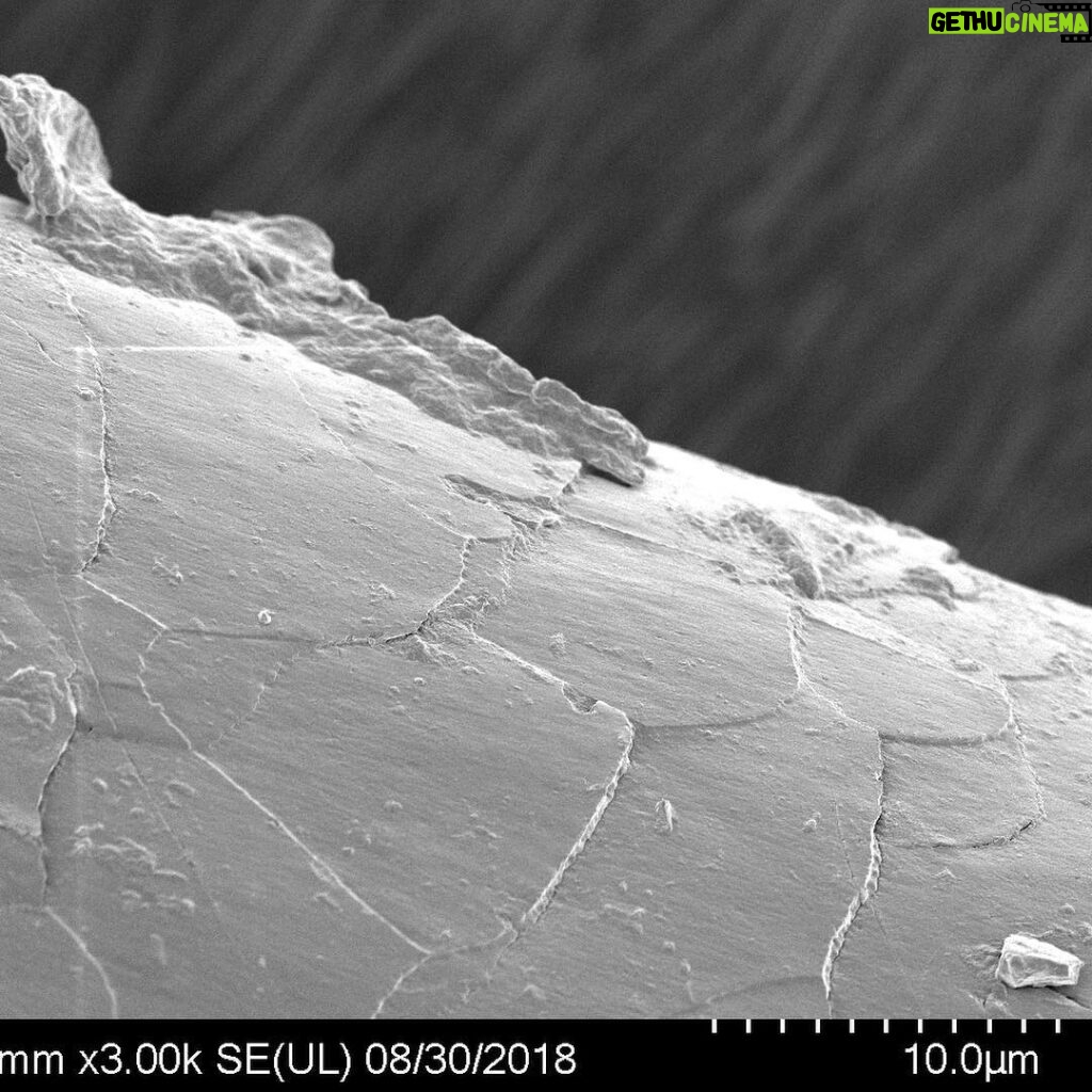 Derek Muller Instagram - This is MY hair, swipe to zoom in. Goop in first shot is hair product. I never thought I would see my hair this close up but thanks to the scientists at @headandshoulderseu I did - as part of my new video they pulled my hair and put it under an electron microscope! Check out the new vid about the fungus on your head: ve42.co #sponsored #headandshoulders