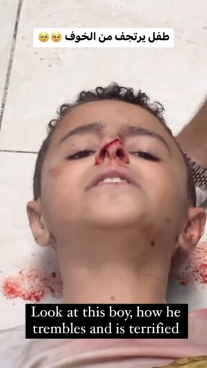 Eman El Assi Instagram - Look at this boy, how he trembles and is terrified . 💔