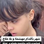 Eman El Assi Instagram – Rital, who had angelic eyes, was crying silently in the hospital corridors. For a whole month, she has been suffering from multiple and complex fractures, and there is no treatment for her in the collapsed hospitals of Gaza. Ten years are all her life, and for her to go back to playing and running is all her ambition! Imagine something simple Rital and tens of thousands of children in Gaza are deprived of the right to treatment, safety, and all their other rights