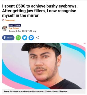 Fox Fisher Instagram - Trans masculine affirming non-surgical procedures aren’t talked about enough, and it’s something that’s brought me instant euphoria 🏳️‍⚧️🌟

I wasn’t blessed with big bushy eyebrows, but this allowed me to achieve something that gives me euphoria about the way I look. And I know, for many trans people, little things like this can make such a difference. 

Thanks @drvincentwong and @jademendes 💜

Before coming out, I started to feel the pressure to conform to stereotypes about how girls are supposed to dress and behave. So, at the age of 11, I signed up for a finishing-school type class, which taught tweens and teens how to preen and prettify our faces.

For my eyebrows specifically, the teacher used me as the example model – showing the girls the best tweezers, where to pluck and how much to remove. This gave me fashionably thin brows, very femme.