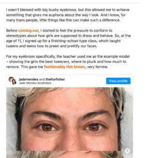 Fox Fisher Instagram - Trans masculine affirming non-surgical procedures aren’t talked about enough, and it’s something that’s brought me instant euphoria 🏳️‍⚧️🌟

I wasn’t blessed with big bushy eyebrows, but this allowed me to achieve something that gives me euphoria about the way I look. And I know, for many trans people, little things like this can make such a difference. 

Thanks @drvincentwong and @jademendes 💜

Before coming out, I started to feel the pressure to conform to stereotypes about how girls are supposed to dress and behave. So, at the age of 11, I signed up for a finishing-school type class, which taught tweens and teens how to preen and prettify our faces.

For my eyebrows specifically, the teacher used me as the example model – showing the girls the best tweezers, where to pluck and how much to remove. This gave me fashionably thin brows, very femme.