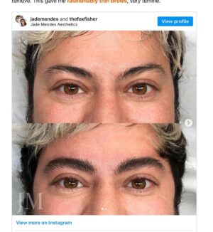 Fox Fisher Instagram - Trans masculine affirming non-surgical procedures aren’t talked about enough, and it’s something that’s brought me instant euphoria 🏳️‍⚧️🌟

I wasn’t blessed with big bushy eyebrows, but this allowed me to achieve something that gives me euphoria about the way I look. And I know, for many trans people, little things like this can make such a difference. 

Thanks @drvincentwong and @jademendes 💜

Before coming out, I started to feel the pressure to conform to stereotypes about how girls are supposed to dress and behave. So, at the age of 11, I signed up for a finishing-school type class, which taught tweens and teens how to preen and prettify our faces.

For my eyebrows specifically, the teacher used me as the example model – showing the girls the best tweezers, where to pluck and how much to remove. This gave me fashionably thin brows, very femme.