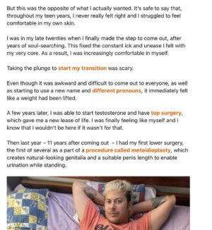 Fox Fisher Instagram - Trans masculine affirming non-surgical procedures aren’t talked about enough, and it’s something that’s brought me instant euphoria 🏳️‍⚧️🌟

I wasn’t blessed with big bushy eyebrows, but this allowed me to achieve something that gives me euphoria about the way I look. And I know, for many trans people, little things like this can make such a difference. 

Thanks @drvincentwong and @jademendes 💜

Before coming out, I started to feel the pressure to conform to stereotypes about how girls are supposed to dress and behave. So, at the age of 11, I signed up for a finishing-school type class, which taught tweens and teens how to preen and prettify our faces.

For my eyebrows specifically, the teacher used me as the example model – showing the girls the best tweezers, where to pluck and how much to remove. This gave me fashionably thin brows, very femme.