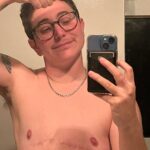 Gabe Dunn Instagram – Happy no-tit a versary to me! My chest is one year older one year wiser. If you wanna get me a gift, donate 1 dollar to my trans love story movie at the links in my bio! I am serious! And if you have any top surgery questions, I’m an open book. Also thank god for squeeze applesauce packets.