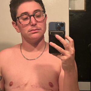 Gabe Dunn Instagram - Happy no-tit a versary to me! My chest is one year older one year wiser. If you wanna get me a gift, donate 1 dollar to my trans love story movie at the links in my bio! I am serious! And if you have any top surgery questions, I’m an open book. Also thank god for squeeze applesauce packets.