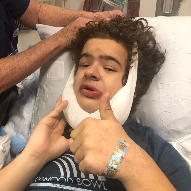 Gaten Matarazzo Instagram - Though my expression in this picture may not show it, the surgery was a complete success😂. This was such A big one, it may be the last one I need. Hopefully at least. Those who suffer from Cleidocranial Dysplasia usually have Supernumerary teeth, which are extra teeth that grow in the gums. I’ve had several surgeries to extract these teeth from within my gums and help expose the teeth that should have already grown in considering my age. In this surgery, the team of amazing medical professionals extracted 14 supernumerary teeth and exposed six of my adult teeth. I was under for four hours. My recovery for the past few days has been great and I can’t thank the team that did the surgery enough. Thank you all for your kind wishes and prayers. It means a lot. Again, if you’d like to learn more about Cleidocranial Dysplasia, you can go to ccdsmiles.org. Thanks again everyone