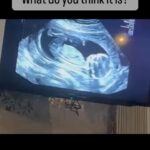 Harry Kane Instagram - Over the moon to be expecting baby No.4! Coming soon… ❤️