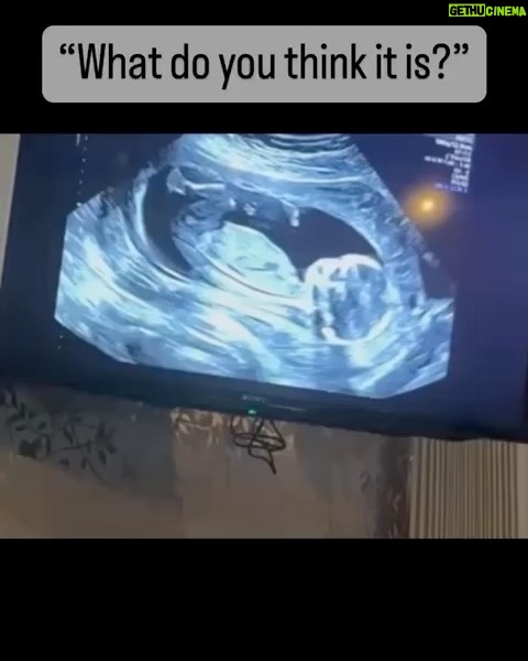 Harry Kane - 611K Likes - Over the moon to be expecting baby No.4! Coming soon… ❤️