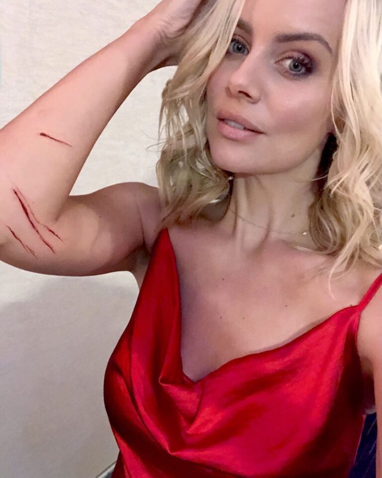 Helena Mattsson Instagram - Filming fight scenes can hurt FOR REAL...ouch!#actresslife#action