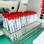 Hendrik Streeck Instagram - Last SARSCoV2 screening run for today... It’s not getting boring! Big thanks to the team!🙏🏻 #covid_19 #coronavirus Universitätsklinikum Bonn