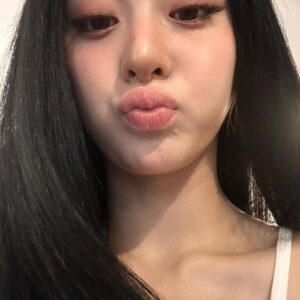 Huh Yun-jin Instagram - at the dentists!