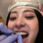 Huh Yun-jin Instagram - at the dentists!