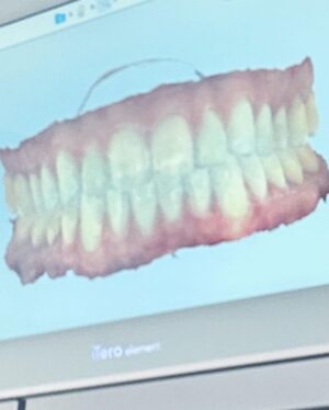 Hunter March Instagram - ✨ this holiday season I’m selling full replicas of my mouth so that you too can experience the joy of having too many teeth ✨