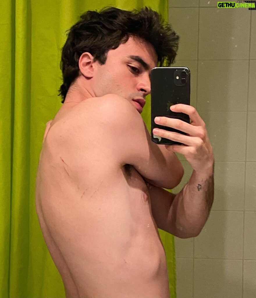 Itzan Escamilla Instagram - scar