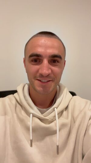 Jason Moloney Instagram - 14 days post hair transplant at @groclinics. 

Here is a little update of where I am at. 
Overall so happy with the whole experience and the results so far! Really excited for what is to come. 
If anyone has any questions for me, feel free to shoot me a message. If you are thinking of getting a transplant yourself, my advice is bloody go for it! Reach out to @groclinics and get the ball rolling.