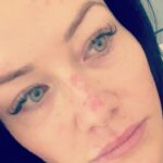 Jess Impiazzi Instagram - Life isn’t always going to go to plan: Social media can trick us easily in to thinking we’ve all got it together! So just wanted to do a real update! The whole IVF failure and other health issues I’m dealing with Atm have made it very difficult to keep out the stress. I’ve done the best I can, I’ve meditated I did practically every spiritual practise I could during that time but i believe I over did it because I was on fight mode, trying to push through the pain of what was going on with my fertility and the emotional, physical and monetary stress that comes with fertility issues and IVF. I’ve taken a step back to rebuild myself and take my foot off the gas for a bit. In doing so I’ve come up in rashes over my body (swipe along) The stress has to come out of us somehow! Sometimes sickness is our Guide! I’ve been reading @gabormatemd #themythofnormal and sometimes our sickness is our body giving us signals to make some changes and it can be our teacher and guide to make those changes! Life isn’t going to be easy, that’s a fact, but if we tune into ourselves instead of using all these crazy distractions to tune out. we might just figure it all out a bit better! I’m feeling much more relaxed and focused on looking after myself again! 💖 so look after yourself everyone and sending lots of love 💖 Just fyi - I’m feeling a lot better in myself now and out the other side! Tuning in and listening to your body is so important! Sending love xx