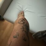 João Guilherme Ávila Instagram – Ontem operei meu joelho.
“Ai meu joelho”
Parte boa: vou melhorar do joelho
Parte ruim: sinto que tem 12 pessoas sentadas no meu joelho 
Em resumo, cuidem dos seus joelhos. 😕 São Paulo, Brazil