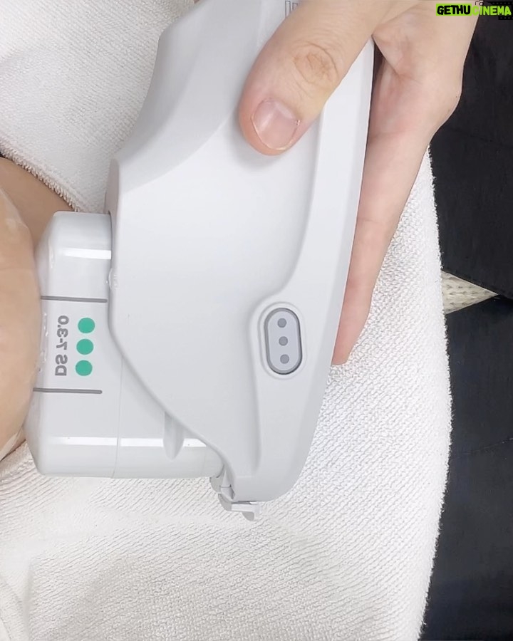 Jo Yoo-jin Instagram - #광고 x @re_you_clinic 연말에 잦은 모임으로 이중턱+볼살쳐짐이 점점 심해지길래 2주 전 , 극약처방하러 #이유클리닉 방문 🙌🏻 제가 추천 받은 #리프팅 레이저 프로그램은 ‘#올리쎄라’라고 ‘올리지오+울쎄라‘가 합쳐진 레이져인데요! 시술후 LDM소노케어 후 관리까지 해주셔서 며칠 뒤 촬영에도 붓기 걱정 없었습니다 😆 이유클리닉에 반해버린 이유 ☝🏻 1. 100% 예약제로 프라이빗한 관리! 2. 원장님이 직접 상담하시고 섬세한 손길의 시술! 허보경 대표 원장님은 서울대 전문의신데 런던 패션 스쿨에서 패션까지 함께 전공하셨대요! 섬세하고 예민한 감각의 터치.. 어느 정도일지 짐작이 가시죠? 🤭 6번 영상은 이중턱보고 충격받은 나.🥹 7번 영상은 시술받고 집에 오는 길에 사라졌던 앞볼 볼륨도 보여서 신난 나.😆 다들 새해가 됬으니 쳐진 피부 끌어 올리러 가요 🤍 #올리쎄라 #울쎄라 #올리지오 #리프팅추천 #압구정피부과 #이유클리닉 #패션닥터 #허보경원장 압구정 Apgujung