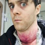 Joey Batey Instagram – Feeling a bit under the weather for some reason. Anyone know a decent remedy?…
…
#witcher #netflix #behindthescenes