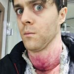 Joey Batey Instagram - Feeling a bit under the weather for some reason. Anyone know a decent remedy?... ... #witcher #netflix #behindthescenes