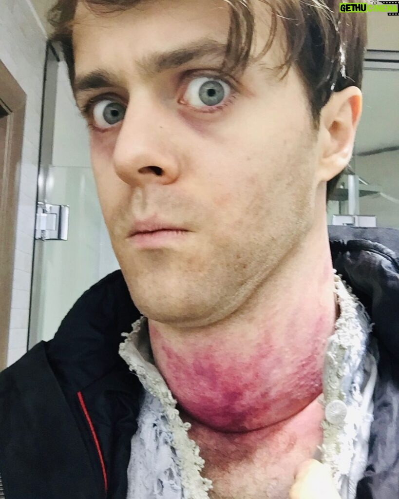 Joey Batey Instagram - Feeling a bit under the weather for some reason. Anyone know a decent remedy?... ... #witcher #netflix #behindthescenes