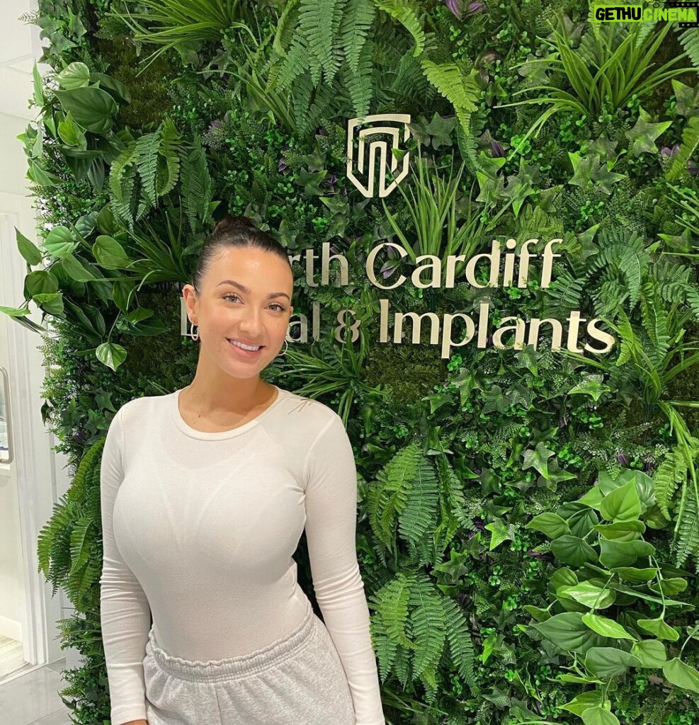 Joey Fisher Instagram - Guess who got their brace off?! I still have a little bit to go with the bottom teeth but I am SO happy with the results. All thanks to the amazing team at @northcardiffdentalimplants, I can’t thank you all enough! Cardiff