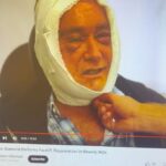Kate Beckinsale Instagram - @drjasondiamond explaining the difference between a cosmetic surgery bandage and a dental surgery ice wrap when he could have been happily playing golf and I could have been recuperating without thousands of accusatory comments and snide tabloid inferences for posting a photo I thought might tickle my mother. Thanks for clarifying dr D . Really hope we can put this bullshit to bed now..