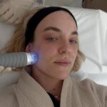 Kateřina Mlejnková Instagram - 1.-2. Microneedling at @aramedicalecce (Omg pak ta nádherná zářivá pleť 🤤) 3.-4. Top jídlo 5. Kostel 6. Vitamíny pod oči, které jsou skvělé na vrásky 7. Yoga time 🙏🏼🫶🏼 Lecce, Italy