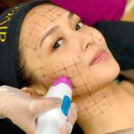 Kathryn Bernardo Instagram - @bernardokath starting the year strong with her favorite annual skin tightening and lifting AIVEE THERMAGE! 🙌💯 ✅ AIVEE THERMAGE is a skin tightening treatment that utilizes radio-frequency (RF) energy to heat the deep layers of the skin. This heat stimulates the production of collagen and elastin, which are the proteins responsible for skin strength and elasticity. As a result, it can diminish the appearance of fine lines and wrinkles, enhance skin tone and texture, and tighten loose skin. DISCLAIMER: Treatments and procedures depend upon consultation. We highly encourage our patients to be examined by our doctors for us to prescribe the proper treatments for your skin and body concern. Treatment costs may be discussed upon consultation. Book your appointment/consultation now by calling or sending us a message here! +639209665613 - Surgery Hotline +639177283838 - Local Hotline +639614514572 - International Hotline +639692230499 - Whatsapp/Viber Or you may call our branches at: 📍 A-INSTITUTE, BGC: +63917 521 0222 📍 FORT, BGC: +63920 966 5529 📍 MEGAMALL: +63917 871 9500 📍VERTIS NORTH: +63917 164 4170 📍 ALABANG: +63917 537 4200 #aivee #theaiveeclinic #aiveeclinic #aiveeday #aiveelove #aiveeleaugue #draivee #drzteo #aiveethermage
