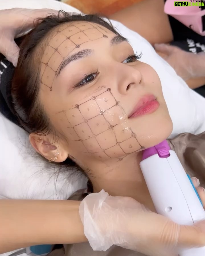 Kathryn Bernardo Instagram - Itβs that time of the year! ππ½ββοΈ Just can't skip my annual Thermage FLX with @theaiveeclinic & @draivee. Thank you for making sure I was comfortable the whole time, @keli.fashion. π