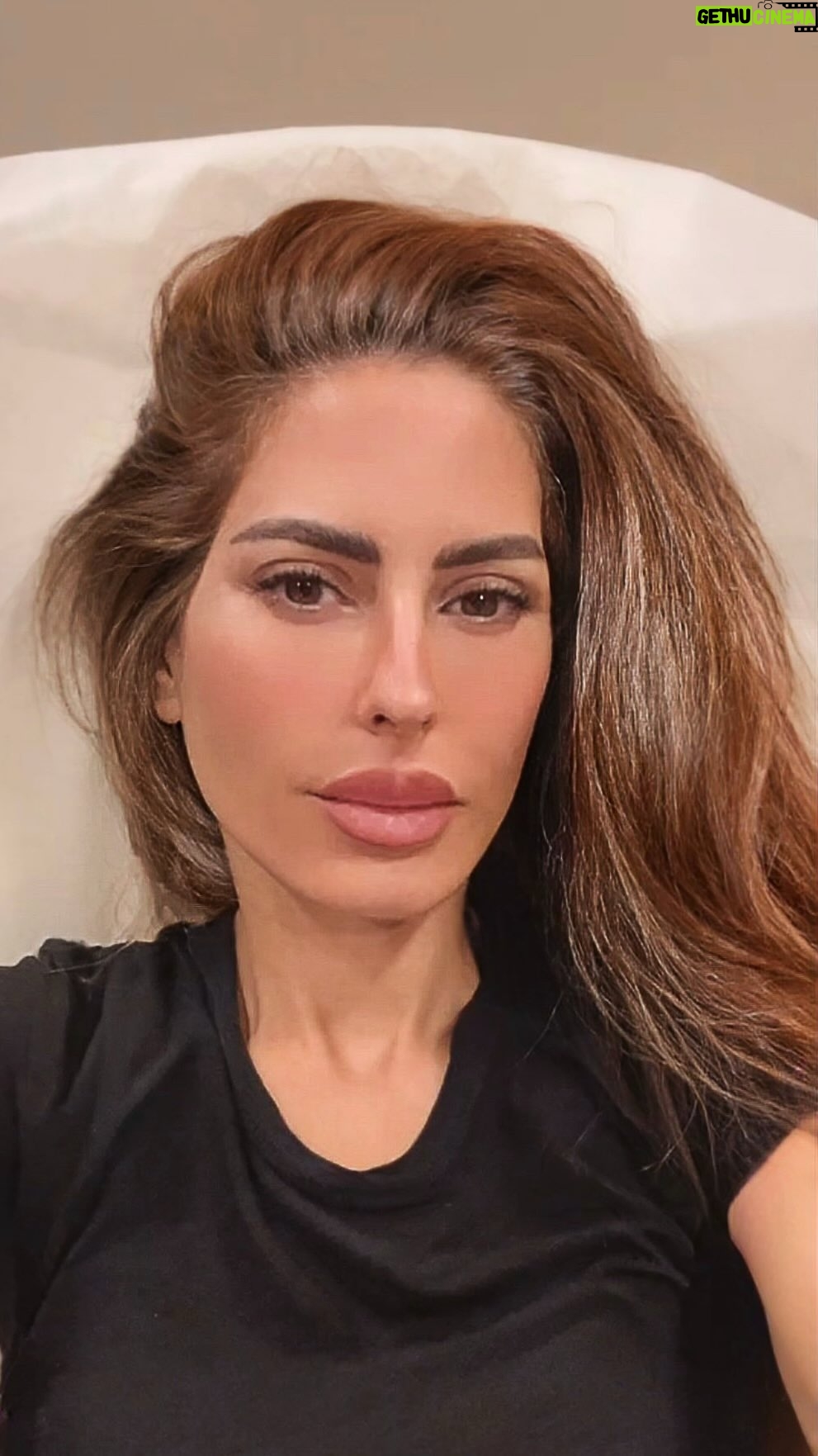 Kerri Kasem Instagram - @labelleviemedspa is one of my most favorite places to get skin tightening. Why? They have one of the best radio frequency machines out there called Morpheus8 but it can be REALLY painful. The topical numbing cream they use is the best! I feel next to nothing. Where, at other places, I literally can’t do the procedure. Here’s what it does… It can improve the appearance of fine lines and wrinkles, tighten lax skin, smooth out rough or uneven skin texture, reduce pore size, treat hyperpigmentation and acne scarring, help fade stretch marks, and even reduce some fat, though not significantly enough that you’d have to worry about volume loss in your face. In addition, Morhpeus8 offers the best value for the money when it comes to getting dramatic results without invasive procedures that can cost 10x the price! #Morpheus8 #SkinTightening #RadioFrequency #LaBellaVie