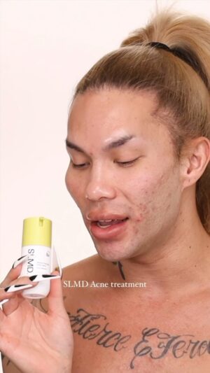 Kimora Blac Instagram - Starting my clear, acne journey with @slmdskincare @drpimplepopper ! Honestly, the skin care combination is so far so easy! Cannot wait for the end results 💥
 
Salicylic acid cleanser @slmdskincare 
Benzoyl peroxide acne lotion @slmdskincare 
Retinol resurfacing serum  @slmdskincare 
Hyaluronic acid moisturizer @slmdskincare 
AHA/ BHA swipes @slmdskincare